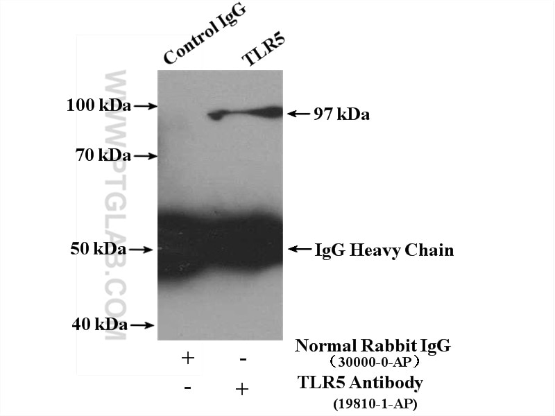 Immunoprecipitation (IP) experiment of HeLa cells using TLR5 Polyclonal antibody (19810-1-AP)