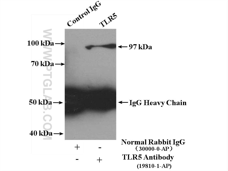 IP experiment of HeLa using 19810-1-AP