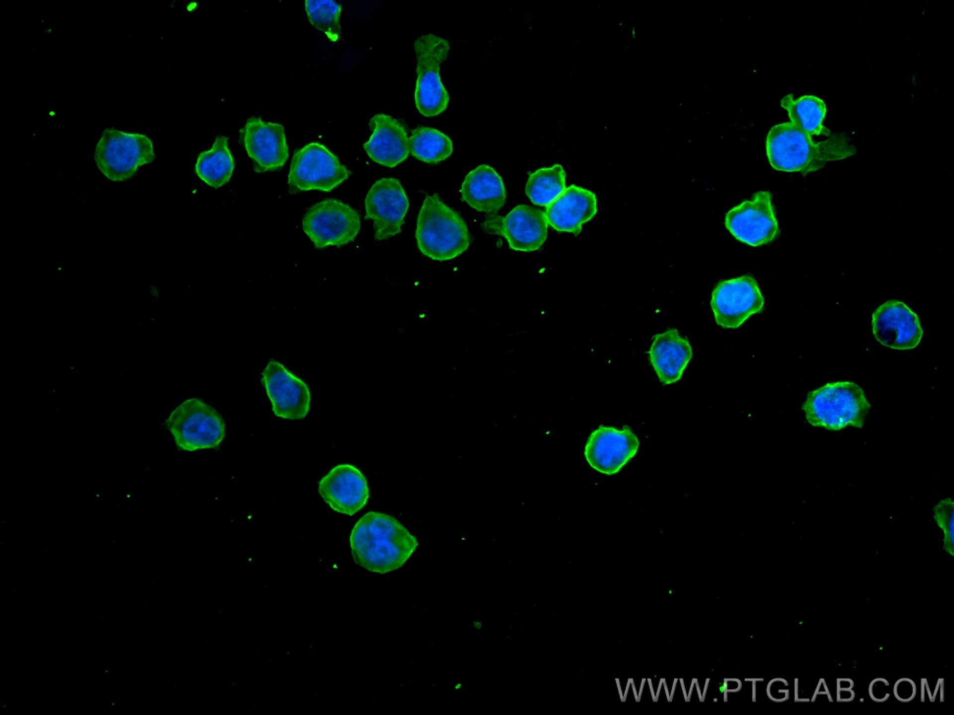 Immunofluorescence (IF) / fluorescent staining of THP-1 cells using TLR5 Monoclonal antibody (66570-1-Ig)