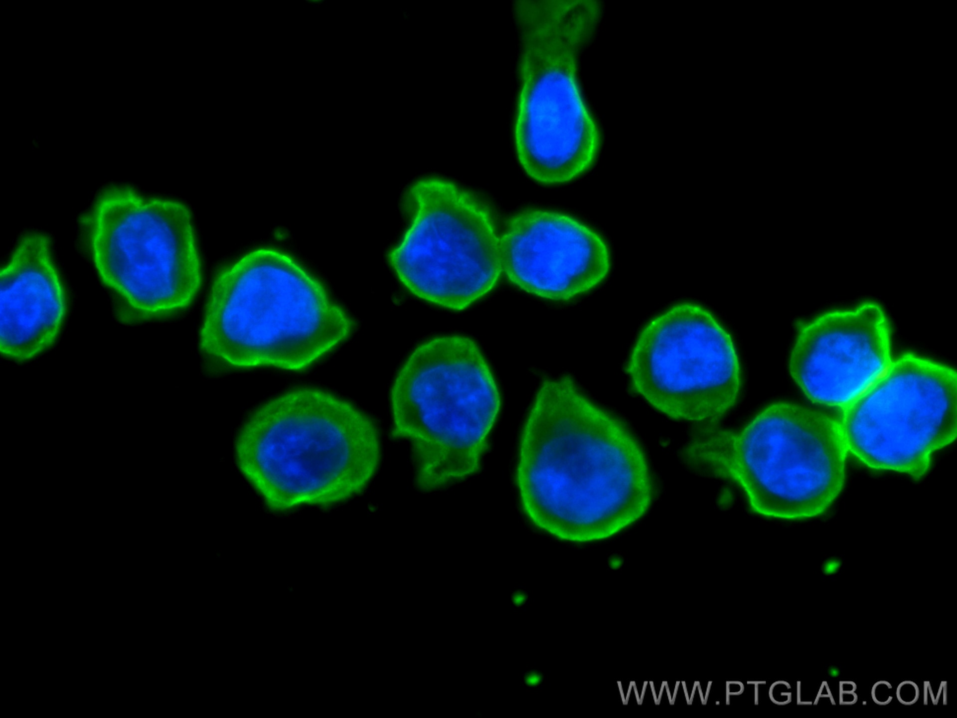 Immunofluorescence (IF) / fluorescent staining of THP-1 cells using TLR5 Monoclonal antibody (66570-1-Ig)