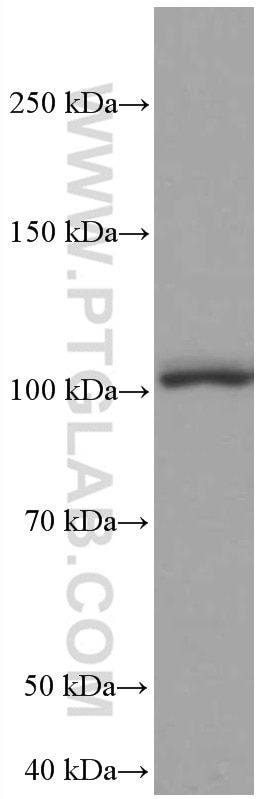 Western Blot (WB) analysis of HeLa cells using TLR5 Monoclonal antibody (66570-1-Ig)