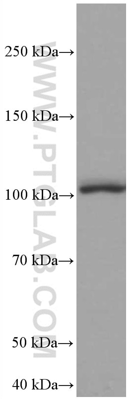 WB analysis of HeLa using 66570-1-Ig