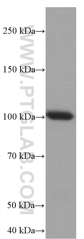 Western Blot (WB) analysis of A549 cells using TLR5 Monoclonal antibody (66570-1-Ig)