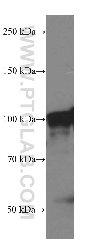 Western Blot (WB) analysis of RAW 264.7 cells using TLR5 Monoclonal antibody (66570-1-Ig)