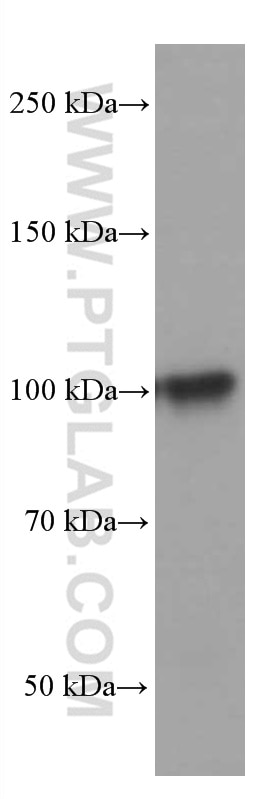 Western Blot (WB) analysis of rat spleen tissue using TLR5 Monoclonal antibody (66570-1-Ig)