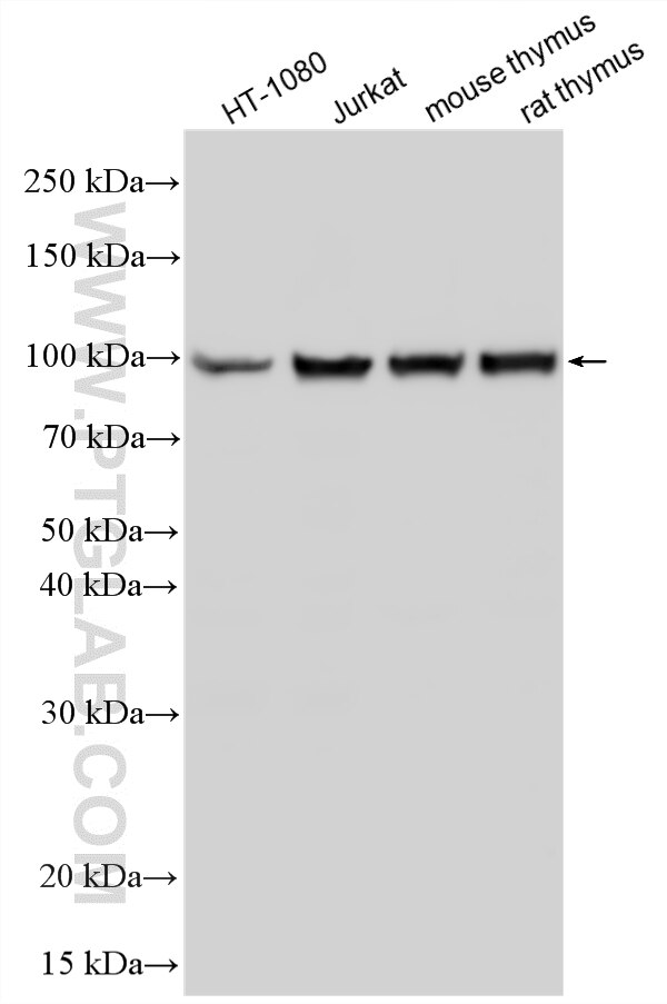 Western Blot (WB) analysis of various lysates using TLR6 Polyclonal antibody (22240-1-AP)