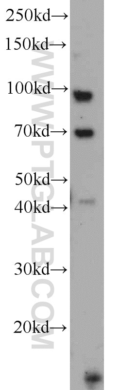 Western Blot (WB) analysis of human brain tissue using TLR6 Polyclonal antibody (22240-1-AP)