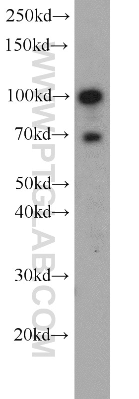 Western Blot (WB) analysis of mouse thymus tissue using TLR6 Polyclonal antibody (22240-1-AP)