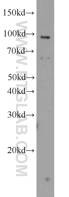 Western Blot (WB) analysis of Jurkat cells using TLR6 Polyclonal antibody (22240-1-AP)