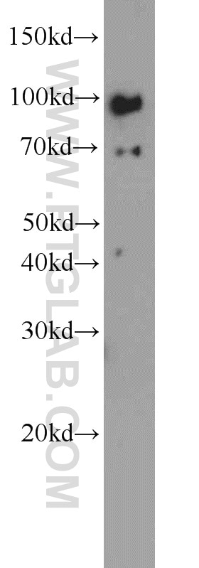 Western Blot (WB) analysis of HT-1080 cells using TLR6 Polyclonal antibody (22240-1-AP)