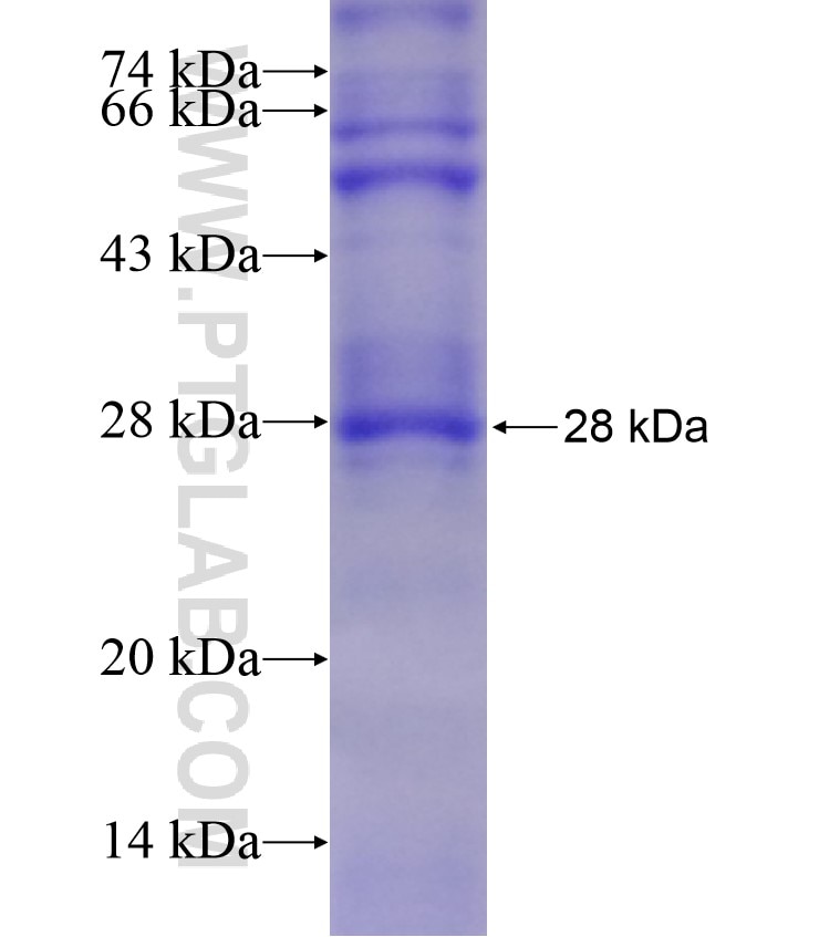 TLR6 fusion protein Ag17686 SDS-PAGE