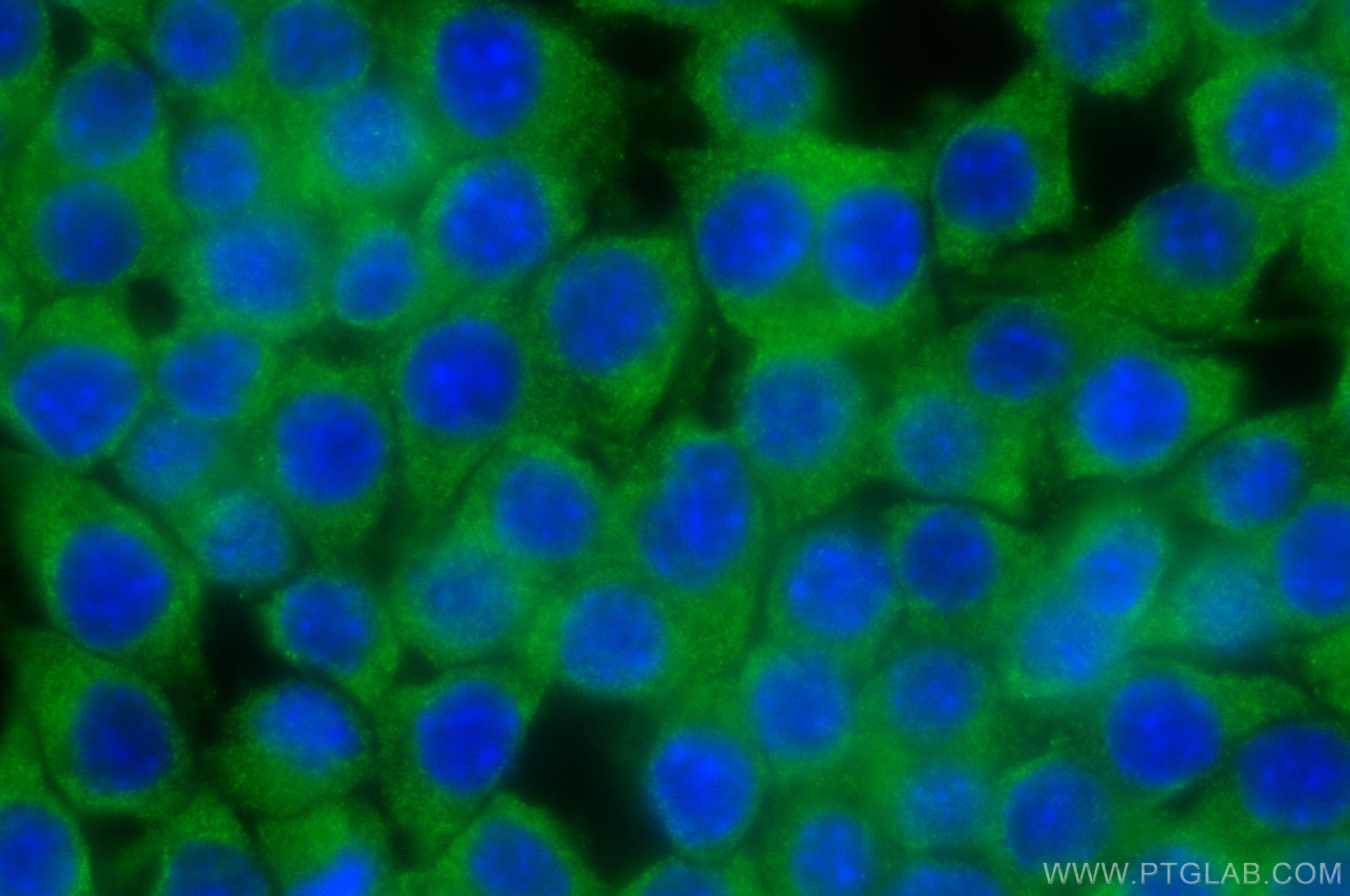 Immunofluorescence (IF) / fluorescent staining of RAW 264.7 cells using TLR7 Polyclonal antibody (17232-1-AP)