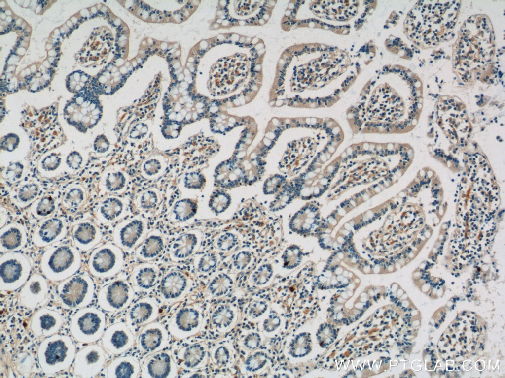 Immunohistochemistry (IHC) staining of human small intestine tissue using TLR7 Polyclonal antibody (17232-1-AP)