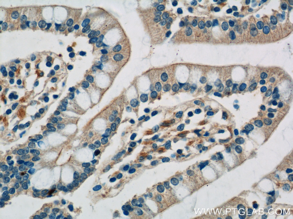 Immunohistochemistry (IHC) staining of human small intestine tissue using TLR7 Polyclonal antibody (17232-1-AP)