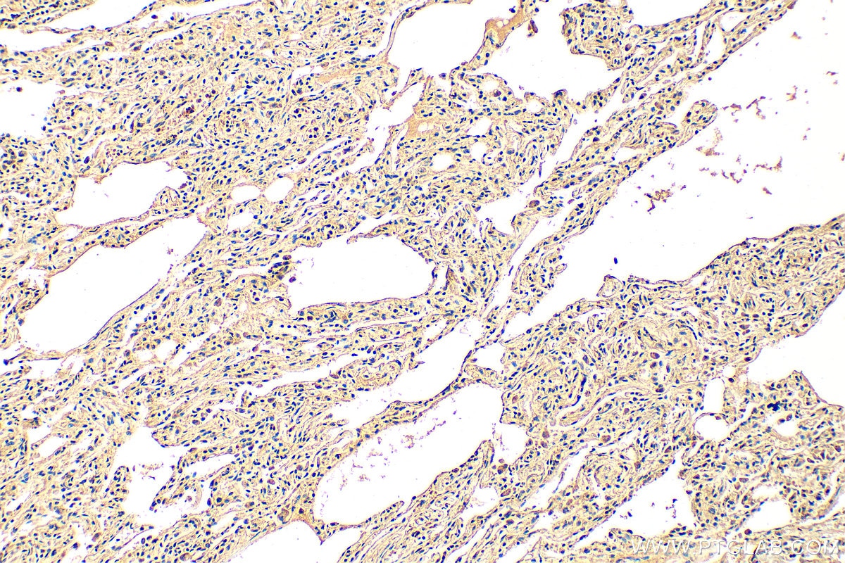 Immunohistochemistry (IHC) staining of human lung tissue using TLR7 Polyclonal antibody (17232-1-AP)