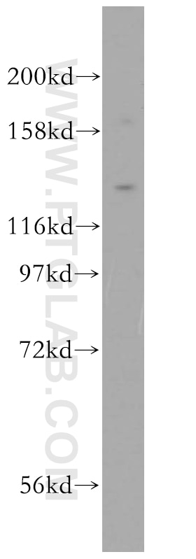 Western Blot (WB) analysis of mouse lung tissue using TLR7 Polyclonal antibody (17232-1-AP)