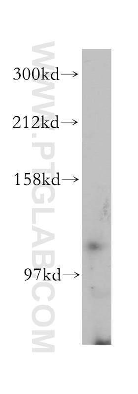 Western Blot (WB) analysis of Jurkat cells using TLR7 Polyclonal antibody (17232-1-AP)