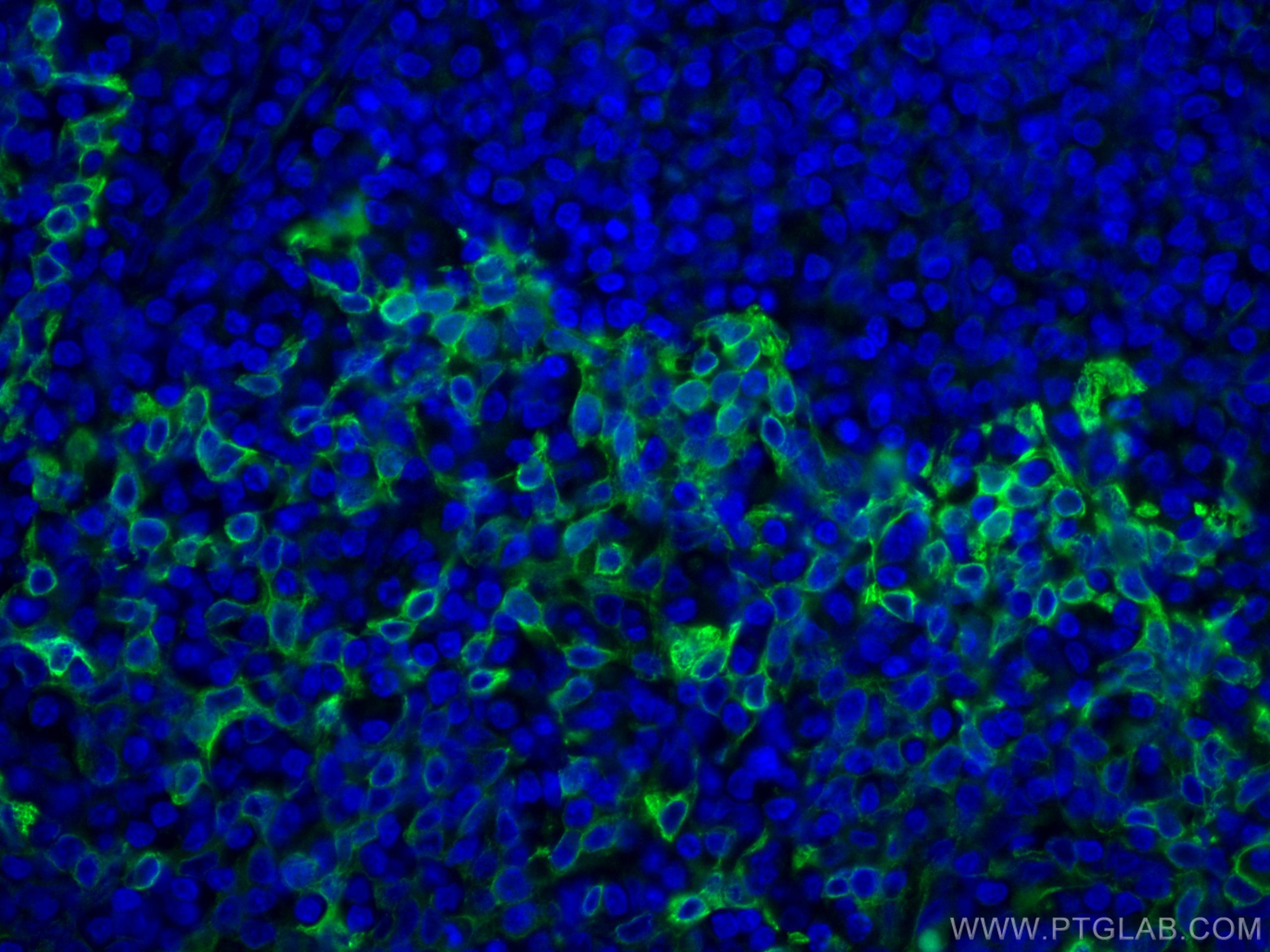 Immunofluorescence (IF) / fluorescent staining of human tonsillitis tissue using TLR8 Monoclonal antibody (67317-1-Ig)