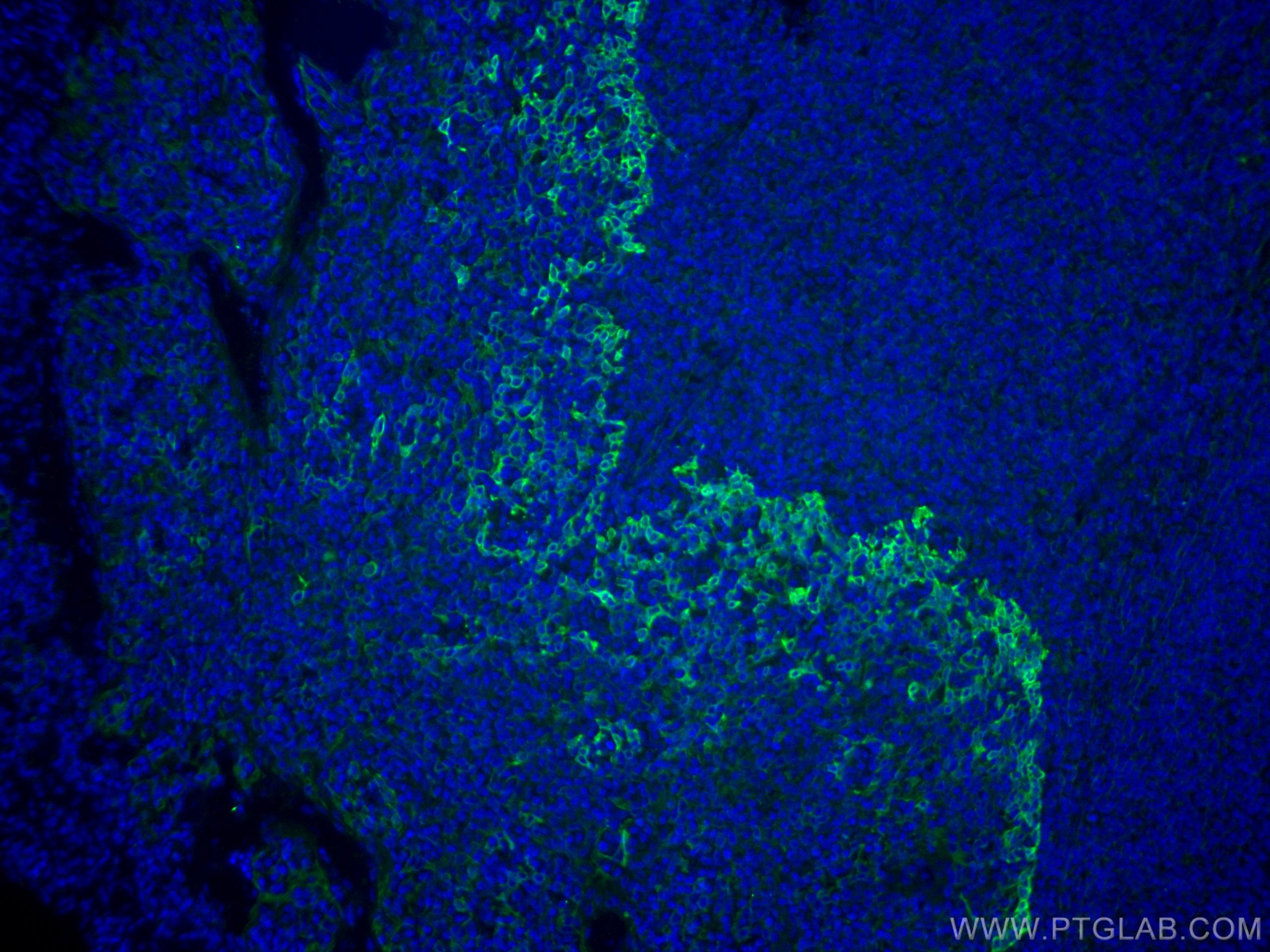 Immunofluorescence (IF) / fluorescent staining of human tonsillitis tissue using TLR8 Monoclonal antibody (67317-1-Ig)