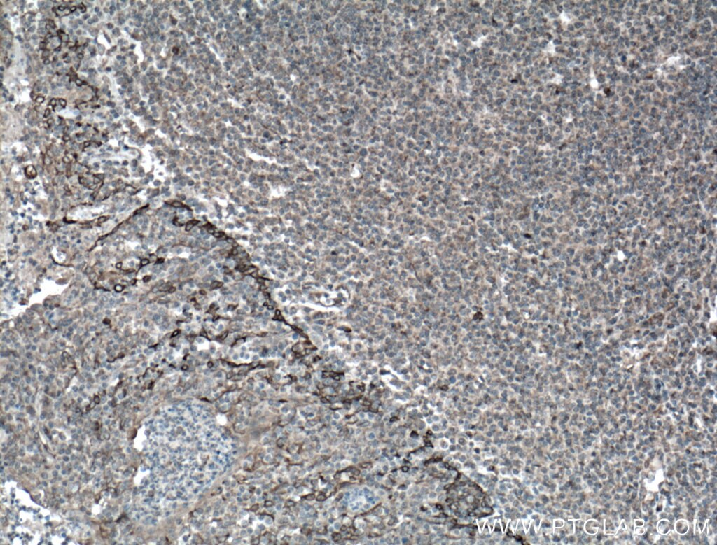 Immunohistochemistry (IHC) staining of human tonsillitis tissue using TLR8 Monoclonal antibody (67317-1-Ig)