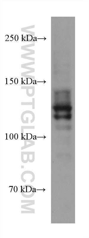 Western Blot (WB) analysis of U-937 cells using TLR8 Monoclonal antibody (67317-1-Ig)