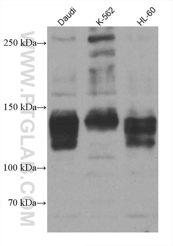 Western Blot (WB) analysis of various lysates using TLR8 Monoclonal antibody (67317-1-Ig)