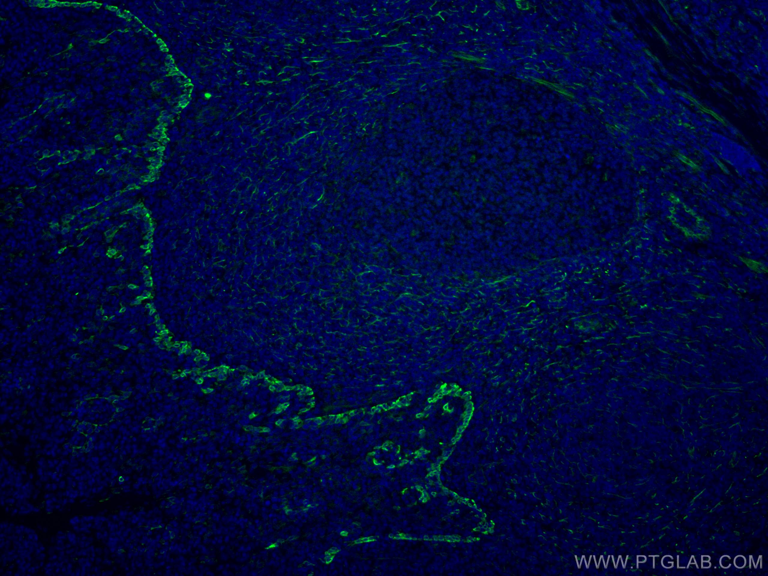 IF Staining of human tonsillitis using CL488-67317