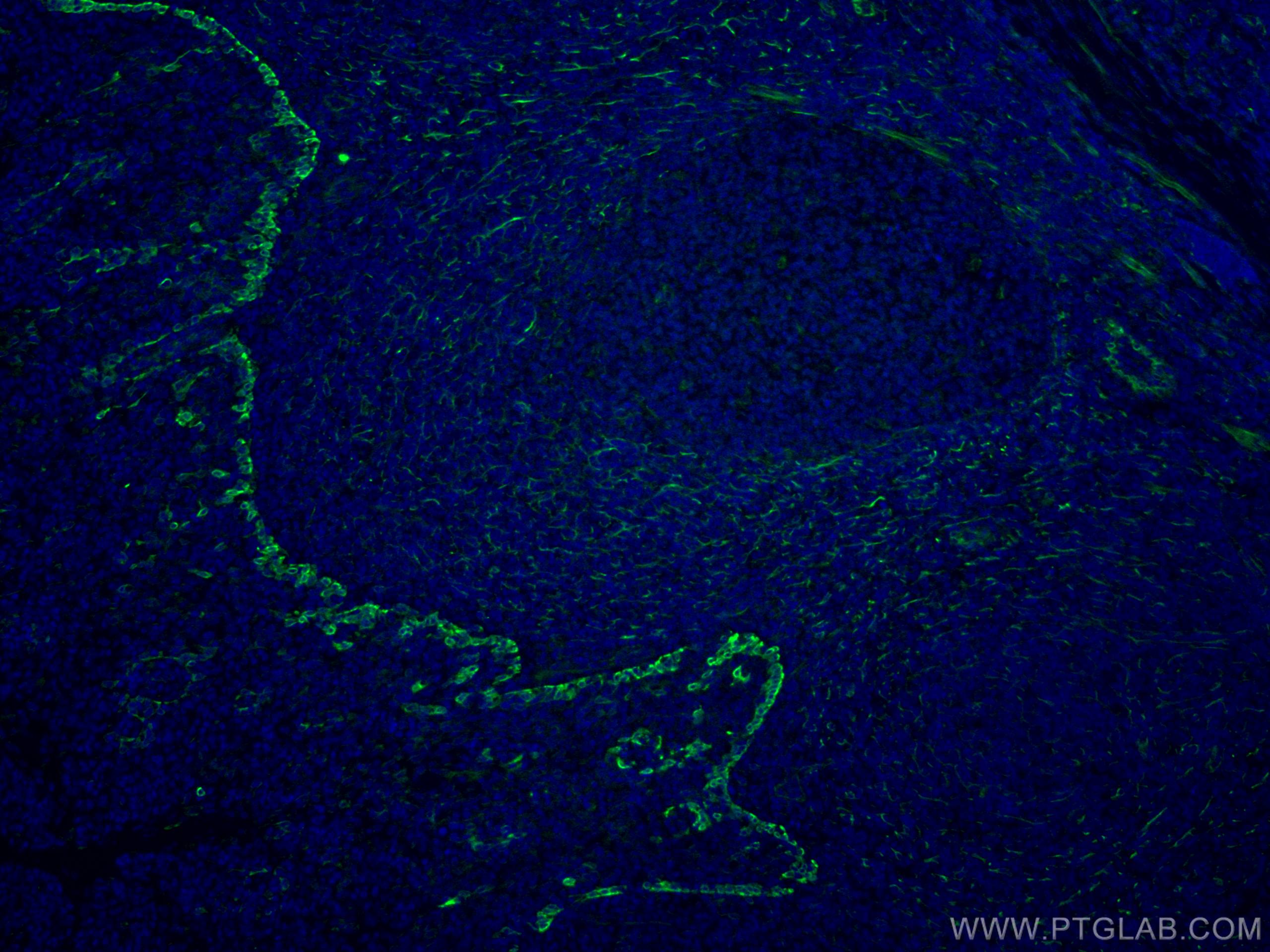 Immunofluorescence (IF) / fluorescent staining of human tonsillitis tissue using CoraLite® Plus 488-conjugated TLR8 Monoclonal anti (CL488-67317)