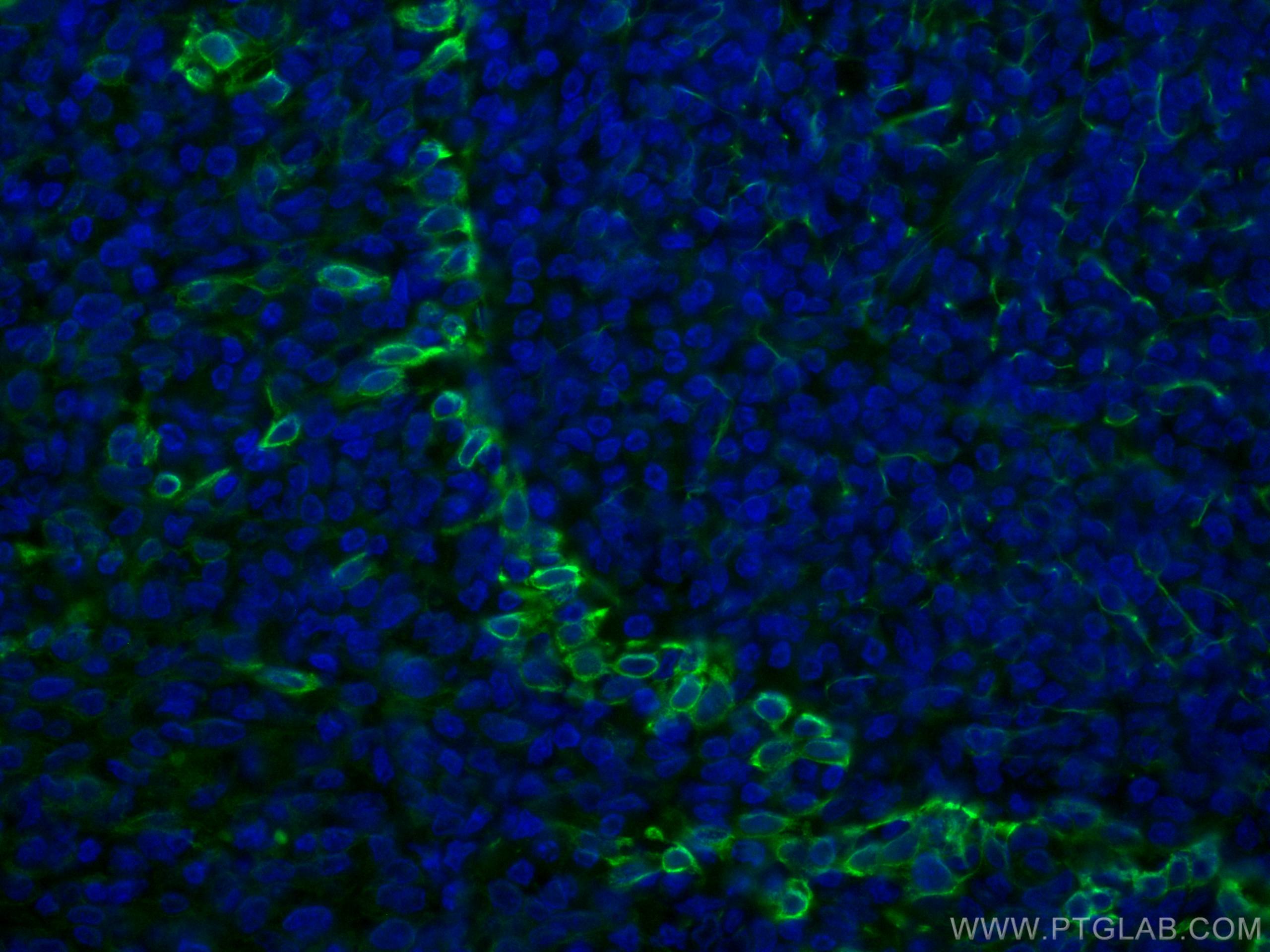 Immunofluorescence (IF) / fluorescent staining of human tonsillitis tissue using CoraLite® Plus 488-conjugated TLR8 Monoclonal anti (CL488-67317)