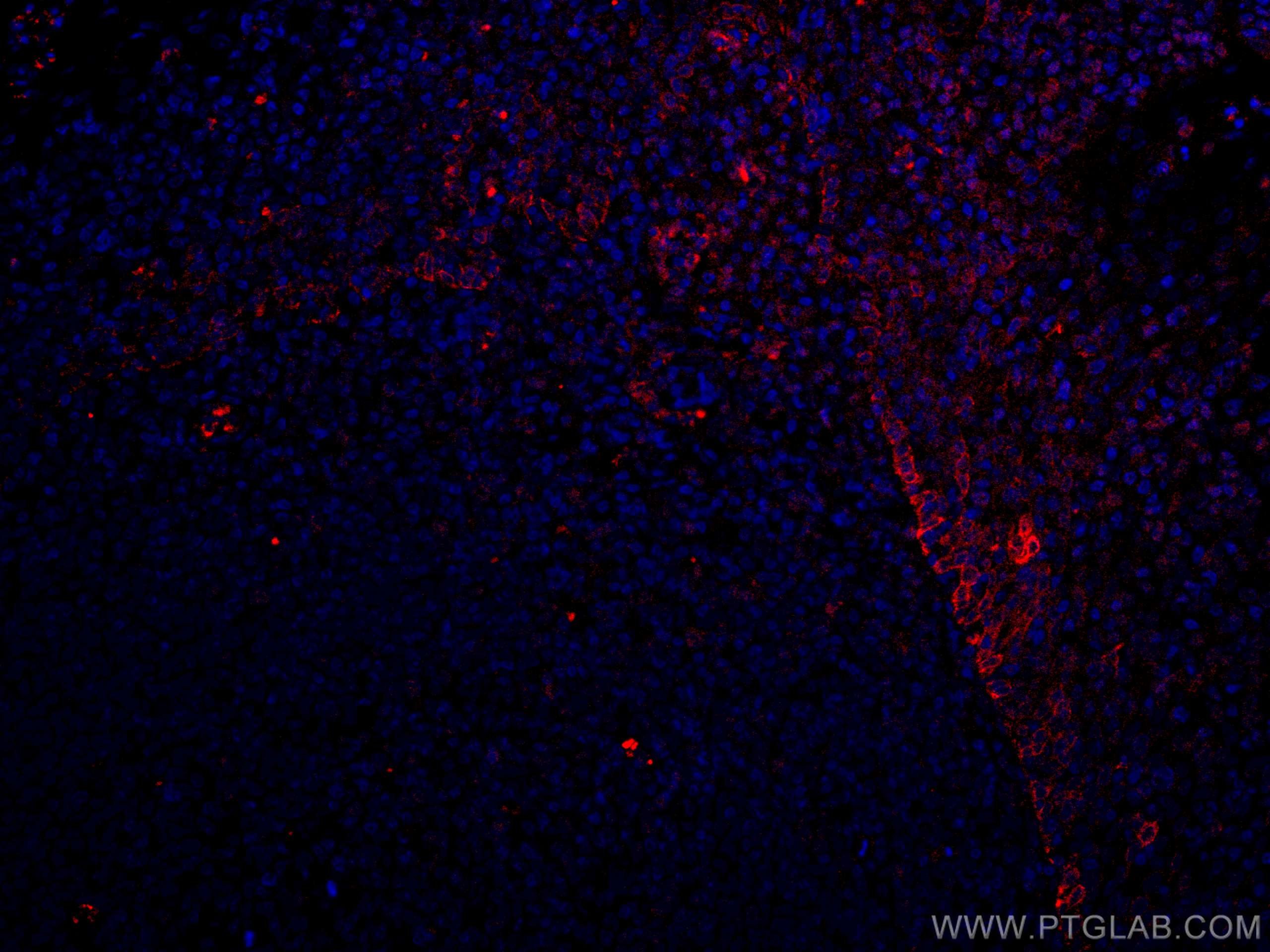 Immunofluorescence (IF) / fluorescent staining of human tonsillitis tissue using CoraLite®594-conjugated TLR8 Monoclonal antibody (CL594-67317)