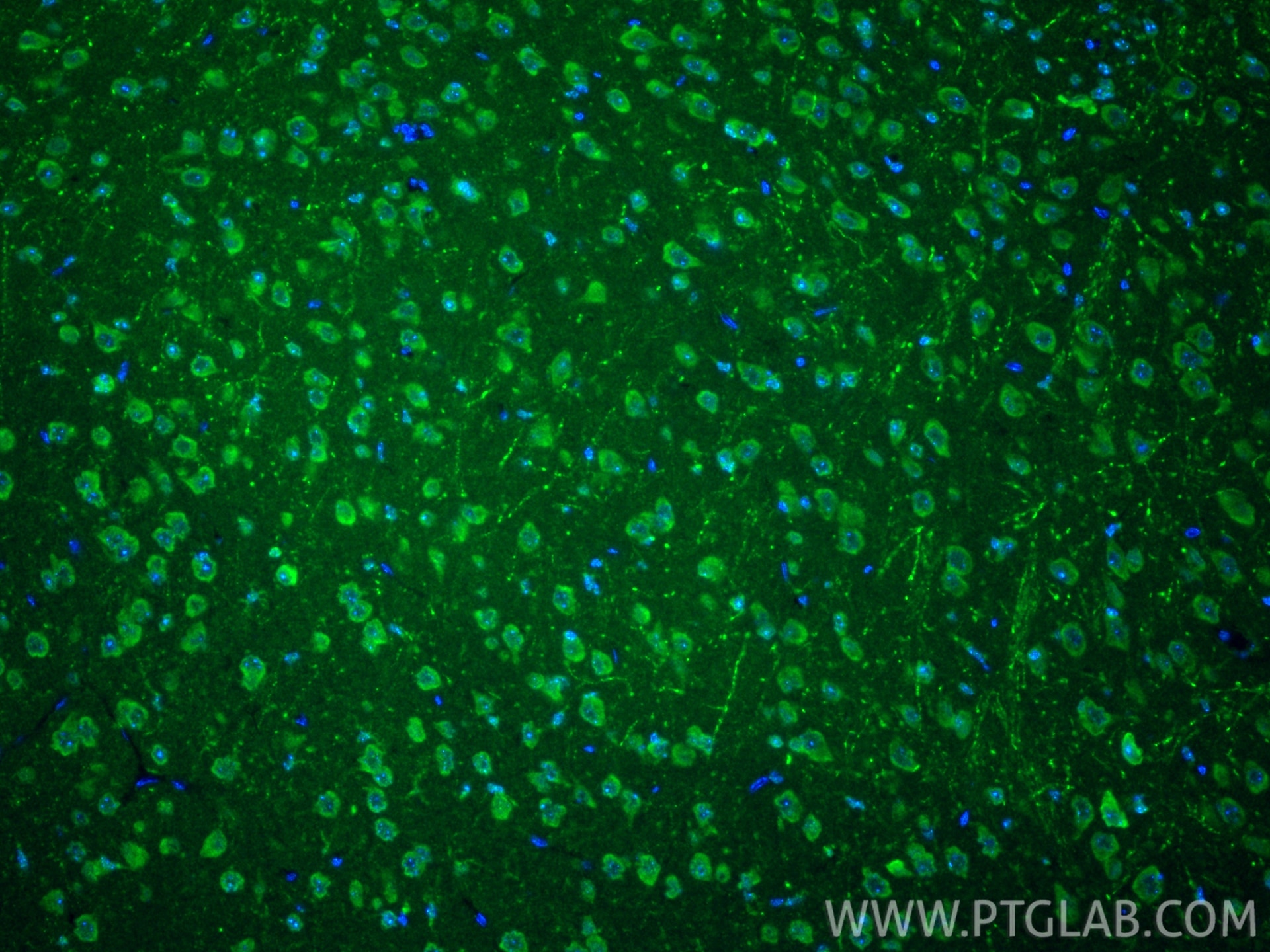 IF Staining of mouse brain using 27769-1-AP Immunofluorescence (IF) / fluorescent staining of mouse brain tissue using TLR9 Polyclonal antibody (27769-1-AP)
