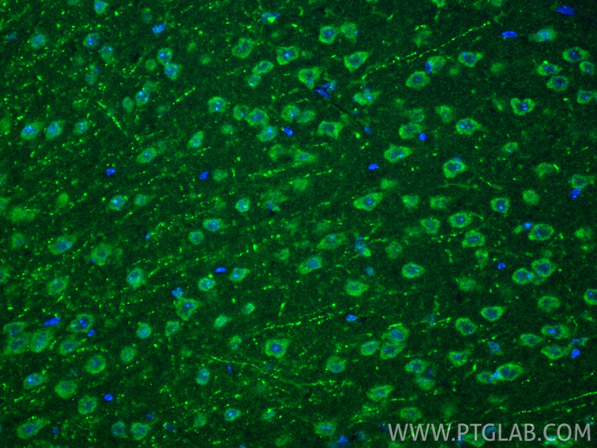IF Staining of mouse brain using 27769-1-AP Immunofluorescence (IF) / fluorescent staining of mouse brain tissue using TLR9 Polyclonal antibody (27769-1-AP)