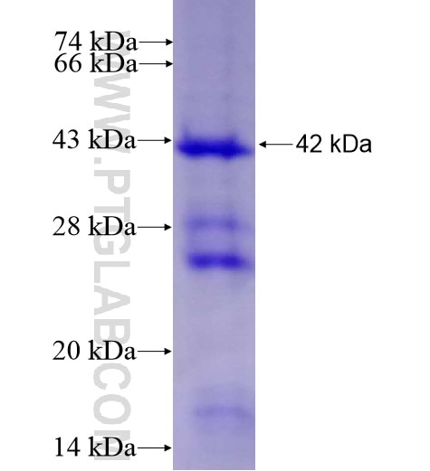 TLR9 fusion protein Ag11122 SDS-PAGE
