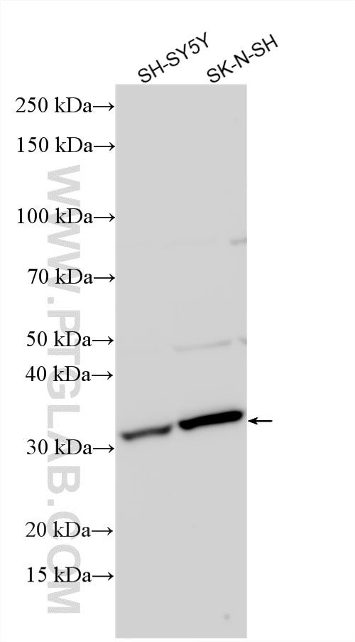 Western Blot (WB) analysis of various lysates using TLX2 Polyclonal antibody (27799-1-AP)