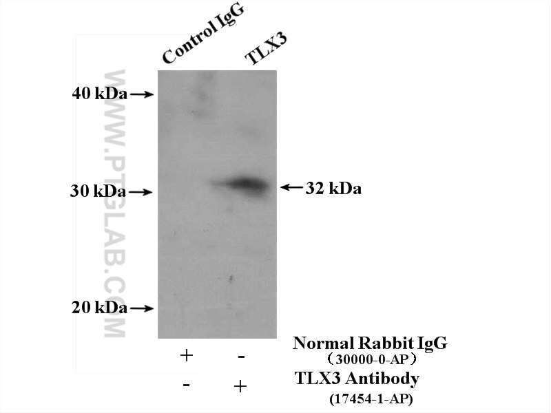 Immunoprecipitation (IP) experiment of Jurkat cells using TLX3 Polyclonal antibody (17454-1-AP)