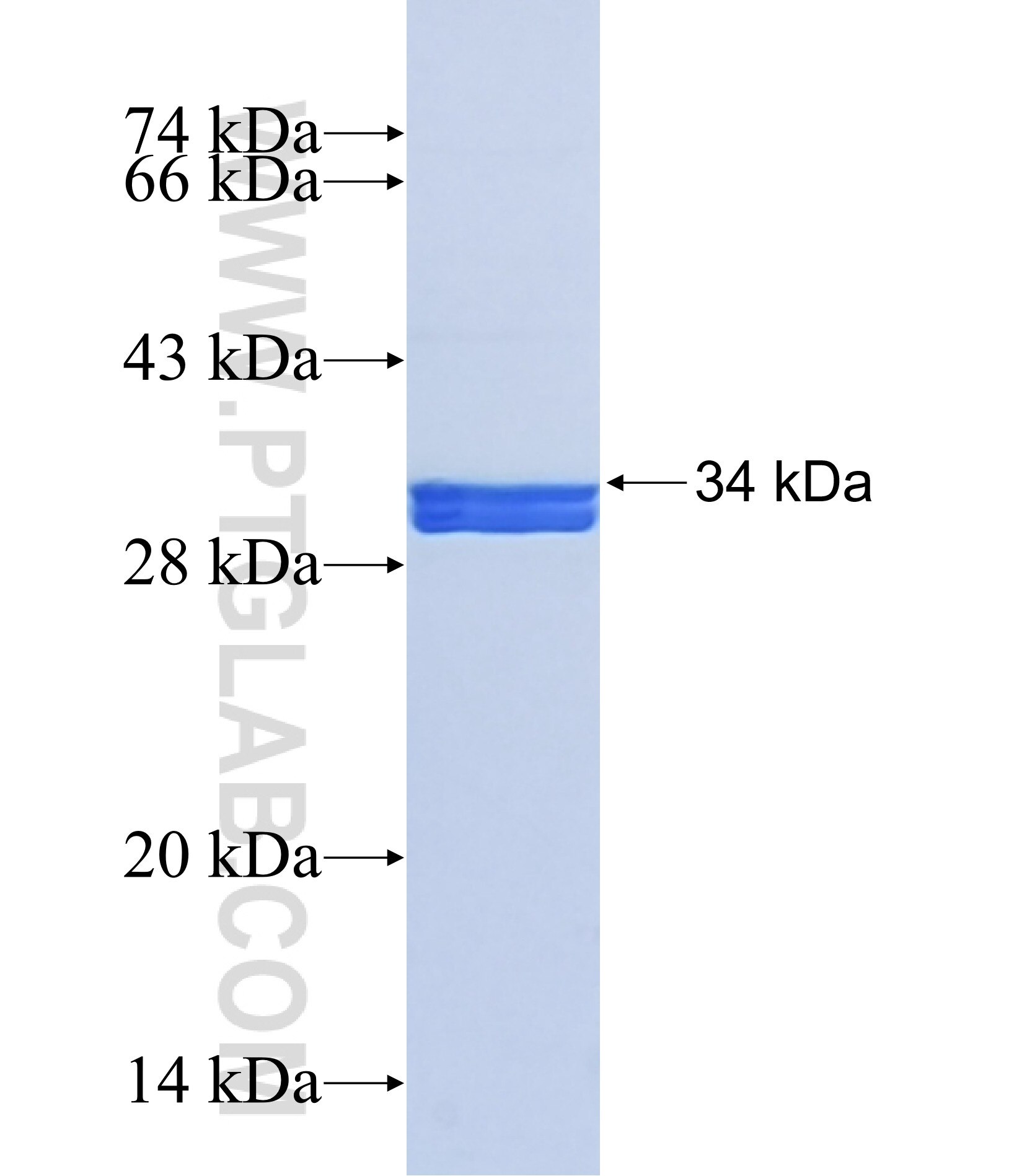 TLX3 fusion protein Ag42028 SDS-PAGE TLX3 fusion protein Ag42028 SDS-PAGE