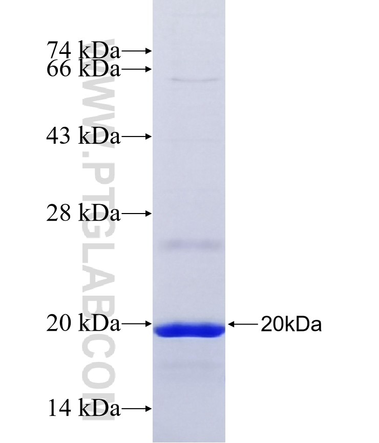 TM2D3 fusion protein Ag40007 SDS-PAGE