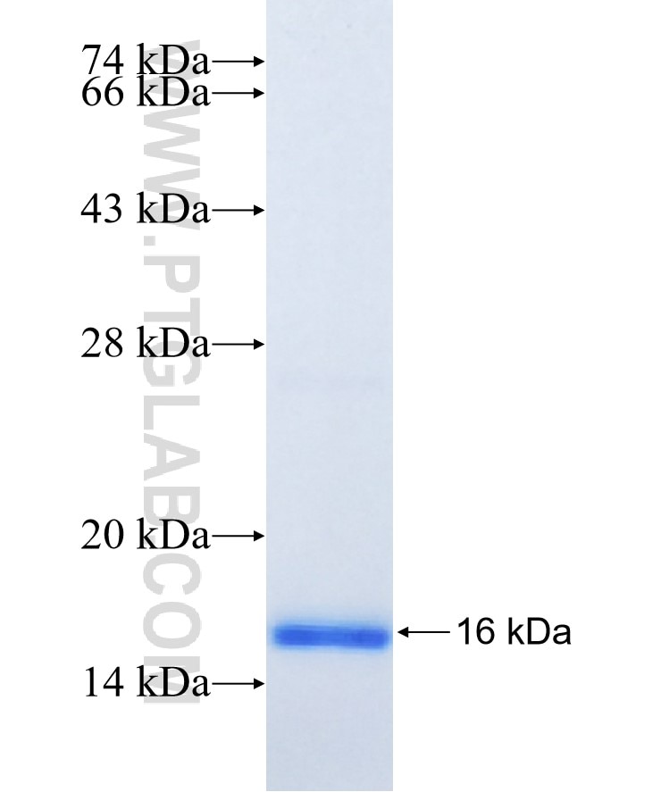 TM4SF20 fusion protein Ag15763 SDS-PAGE
