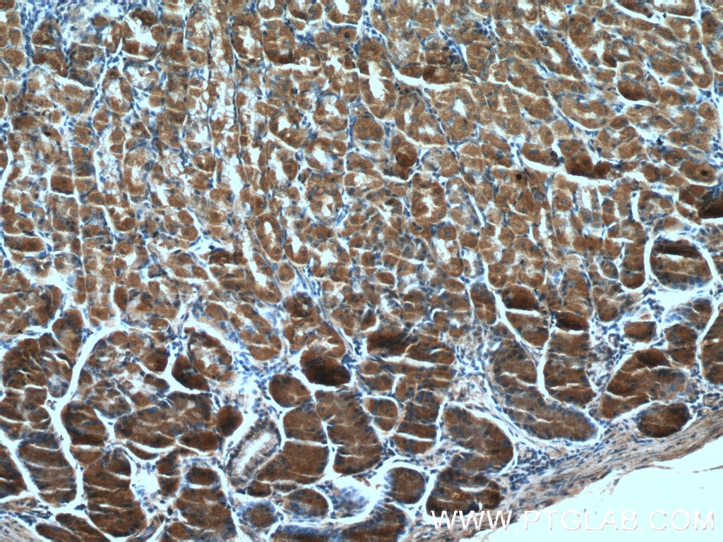 Immunohistochemistry (IHC) staining of human stomach tissue using TM4SF5 Polyclonal antibody (18239-1-AP)