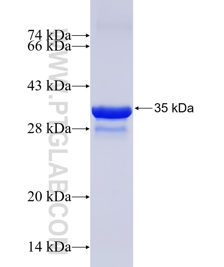 TM4SF5 fusion protein Ag13004 SDS-PAGE