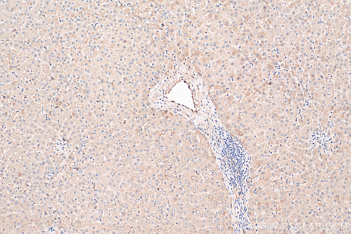 Immunohistochemistry (IHC) staining of human liver tissue using TM6SF2 Polyclonal antibody (27671-1-AP)