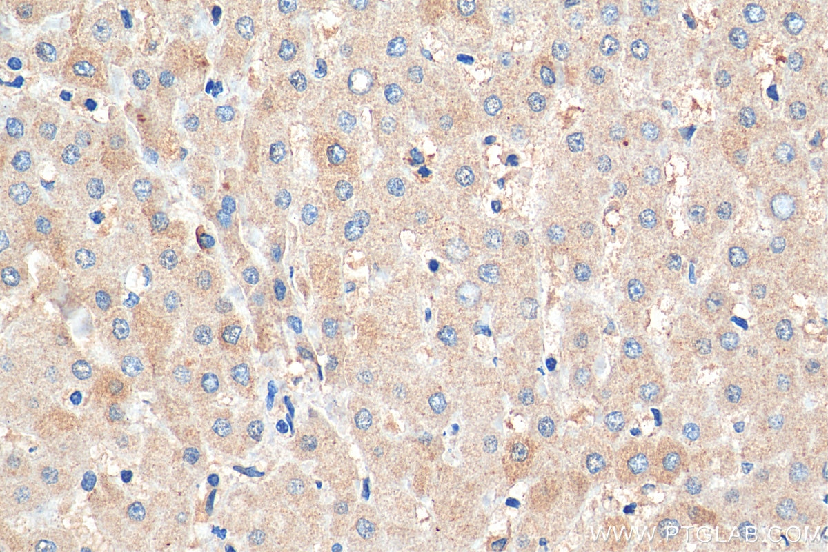 Immunohistochemistry (IHC) staining of human liver tissue using TM6SF2 Polyclonal antibody (27671-1-AP)