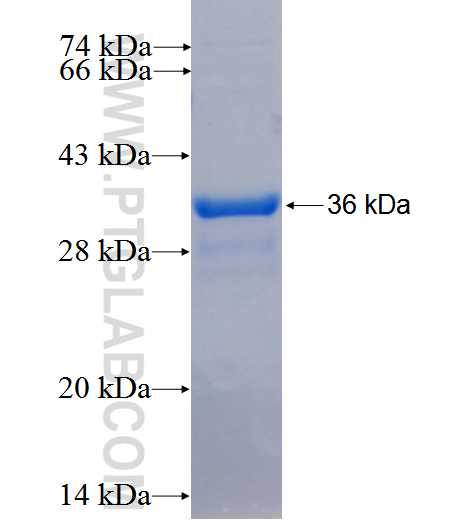 TM6SF2 fusion protein Ag26527 SDS-PAGE