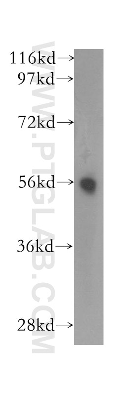 Western Blot (WB) analysis of human lung tissue using TM7SF2 Polyclonal antibody (12033-1-AP)