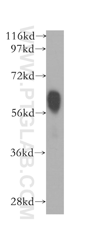 Western Blot (WB) analysis of human kidney tissue using TM7SF2 Polyclonal antibody (12033-1-AP)