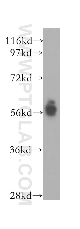 Western Blot (WB) analysis of human heart tissue using TM7SF2 Polyclonal antibody (12033-1-AP)