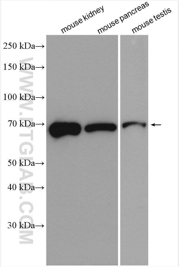 Western Blot (WB) analysis of various lysates using TM7SF3 Polyclonal antibody (19826-1-AP)