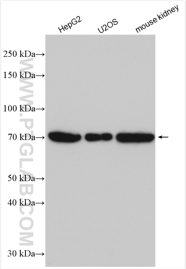 Western Blot (WB) analysis of various lysates using TM7SF3 Polyclonal antibody (19826-1-AP)