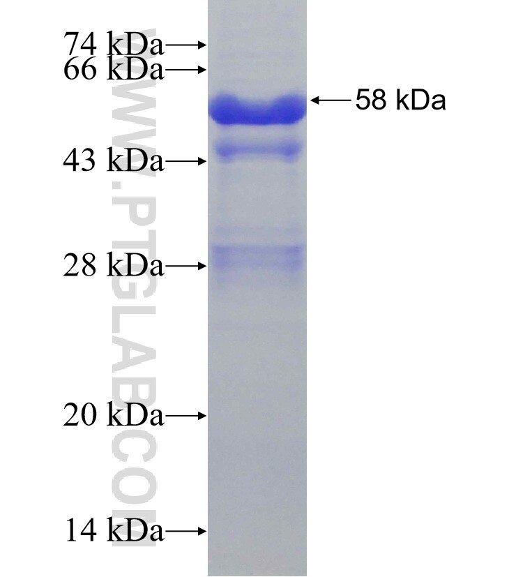 TM7SF3 fusion protein Ag13919 SDS-PAGE