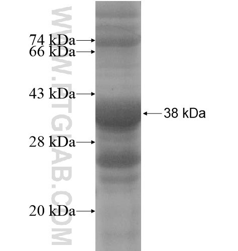 TM7SF3 fusion protein Ag13951 SDS-PAGE